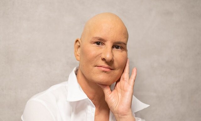 Co nosić na głowie po chemioterapii? Co nosić na głowie po chemioterapii?